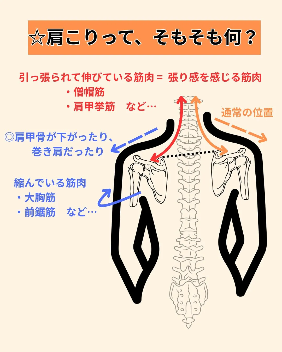 【💡肩こりってなに？】