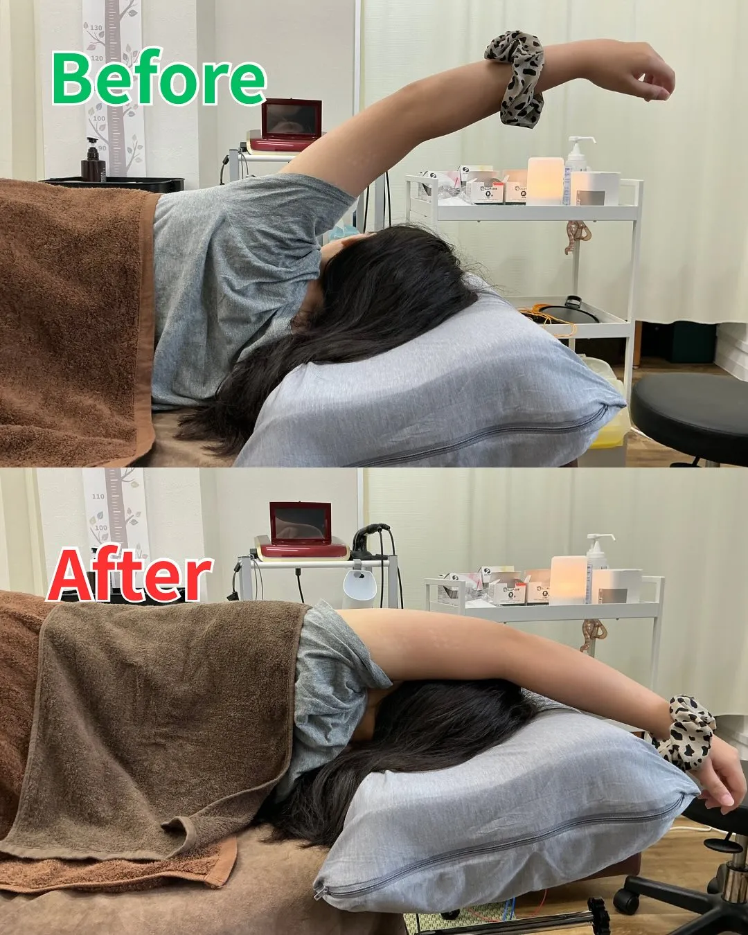 【肩甲骨矯正で姿勢改善＆肩こり解消✨】