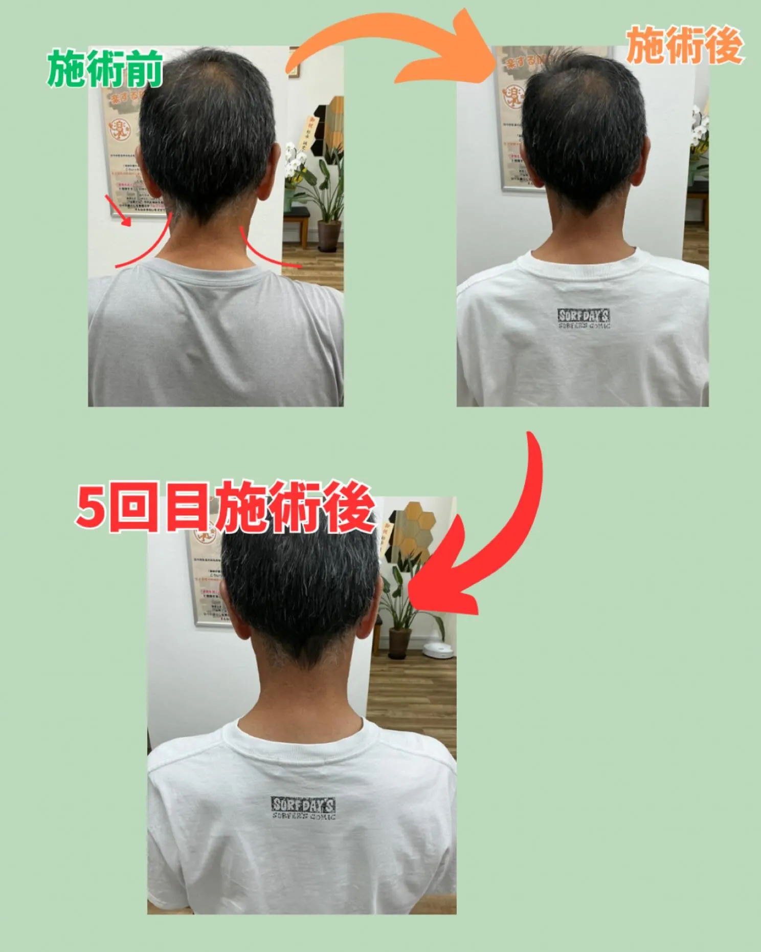 【60代男性の患者さまの改善例】