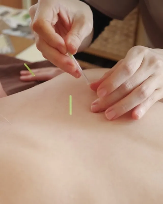 🌿【肩こりには鍼灸が効果的】🌿