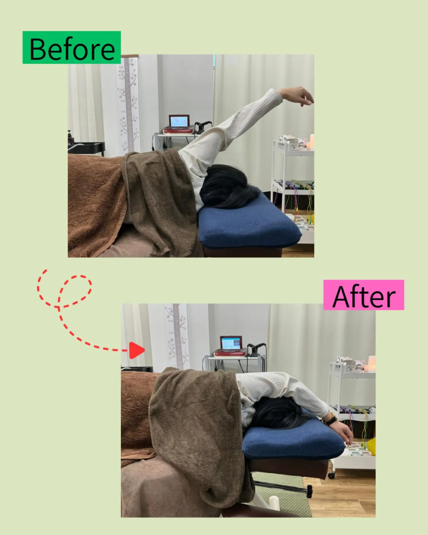 🌿【季節の変わり目に増える！肩こり・首こり・頭痛には鍼灸が効...