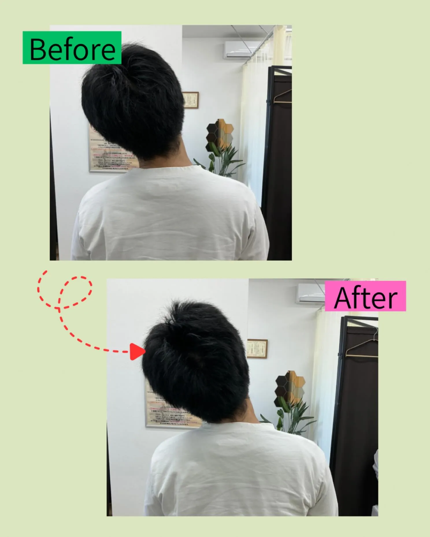 ✨【寝違え・首こりでつらい朝を迎えていませんか？】✨