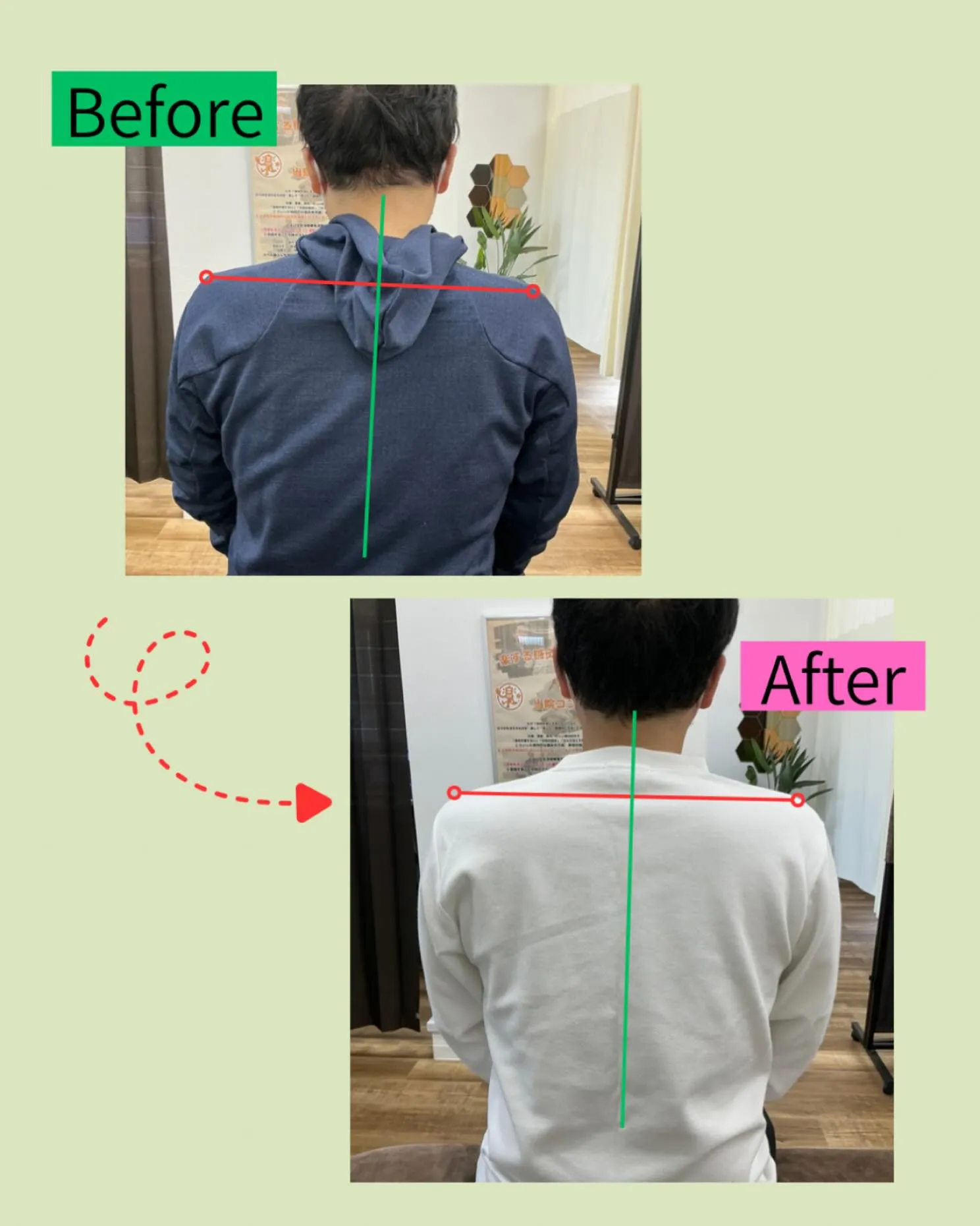 ✨【肩の痛み…実は“身体の傾き”が原因かも？】✨