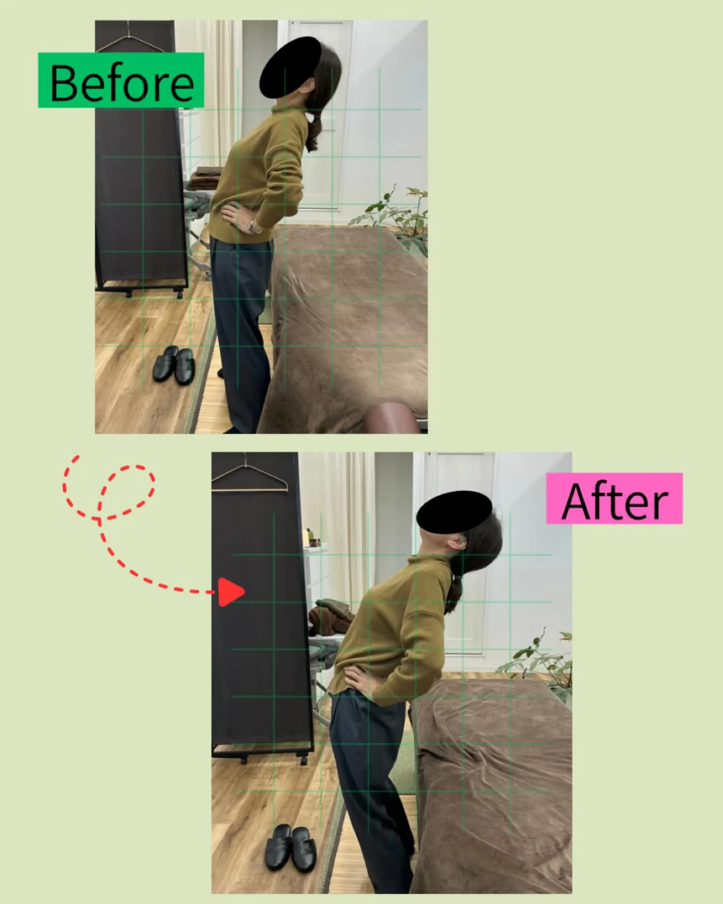 ✨【反り腰による腰のだるさ…そのまま放置していませんか？】✨