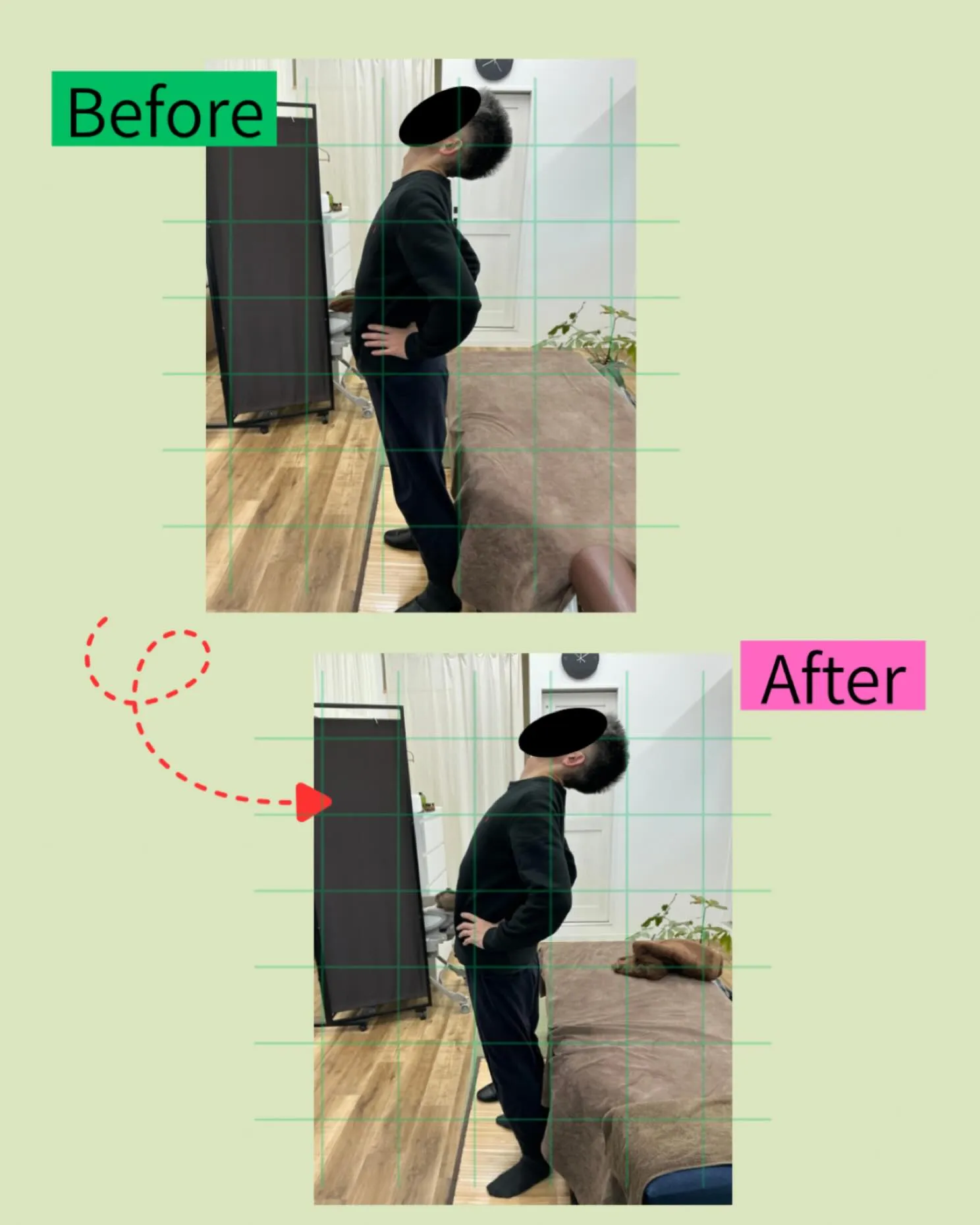 🔥 腰の痛みが続く方、反り腰やギックリ腰にお悩みの方へ 🔥