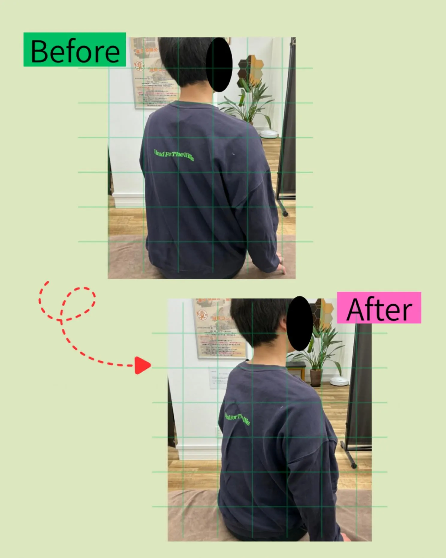 🚗交通事故後のムチウチ・背骨の痛みでお悩みの方へ