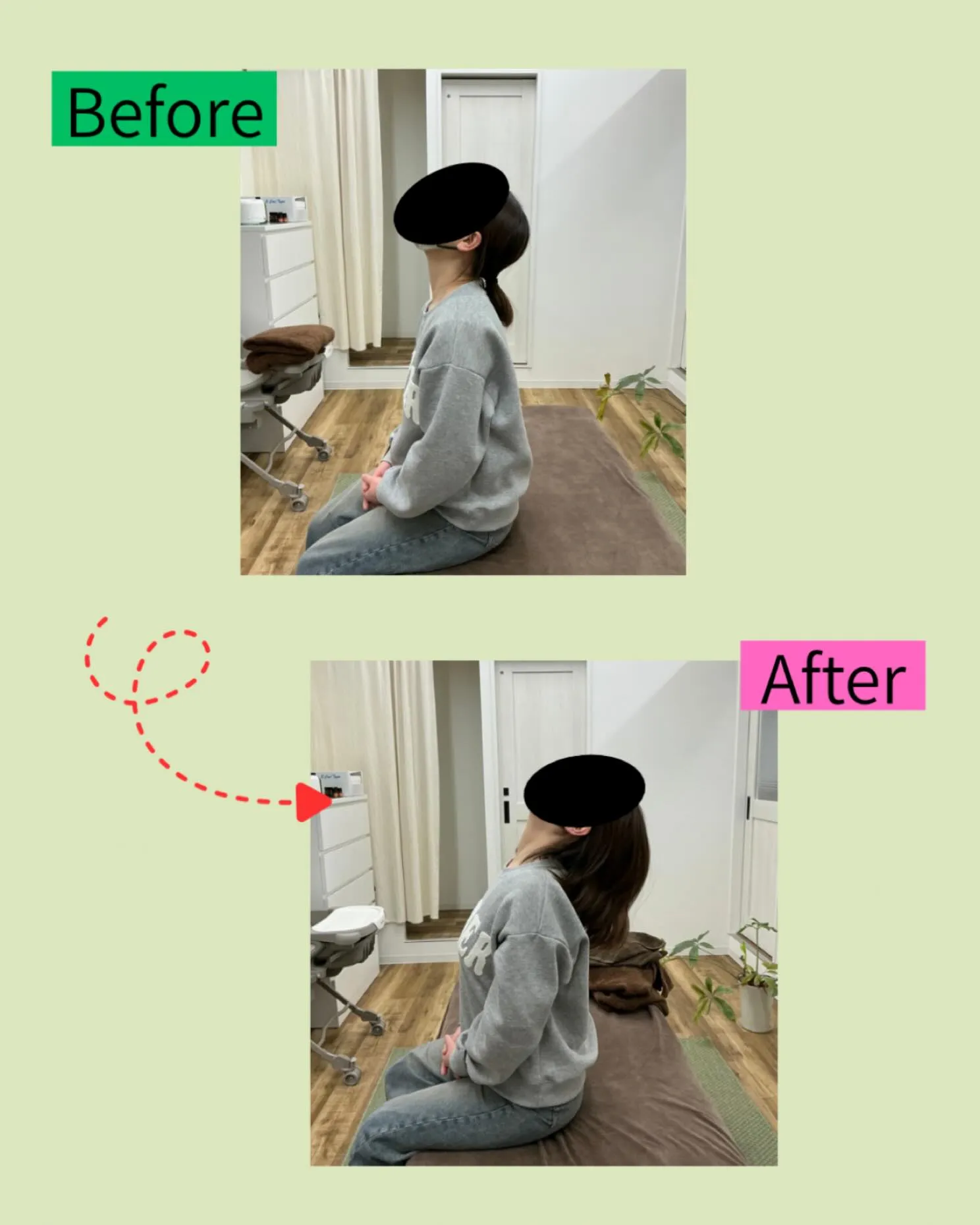 【首こり・寝違えでお悩みの方へ】