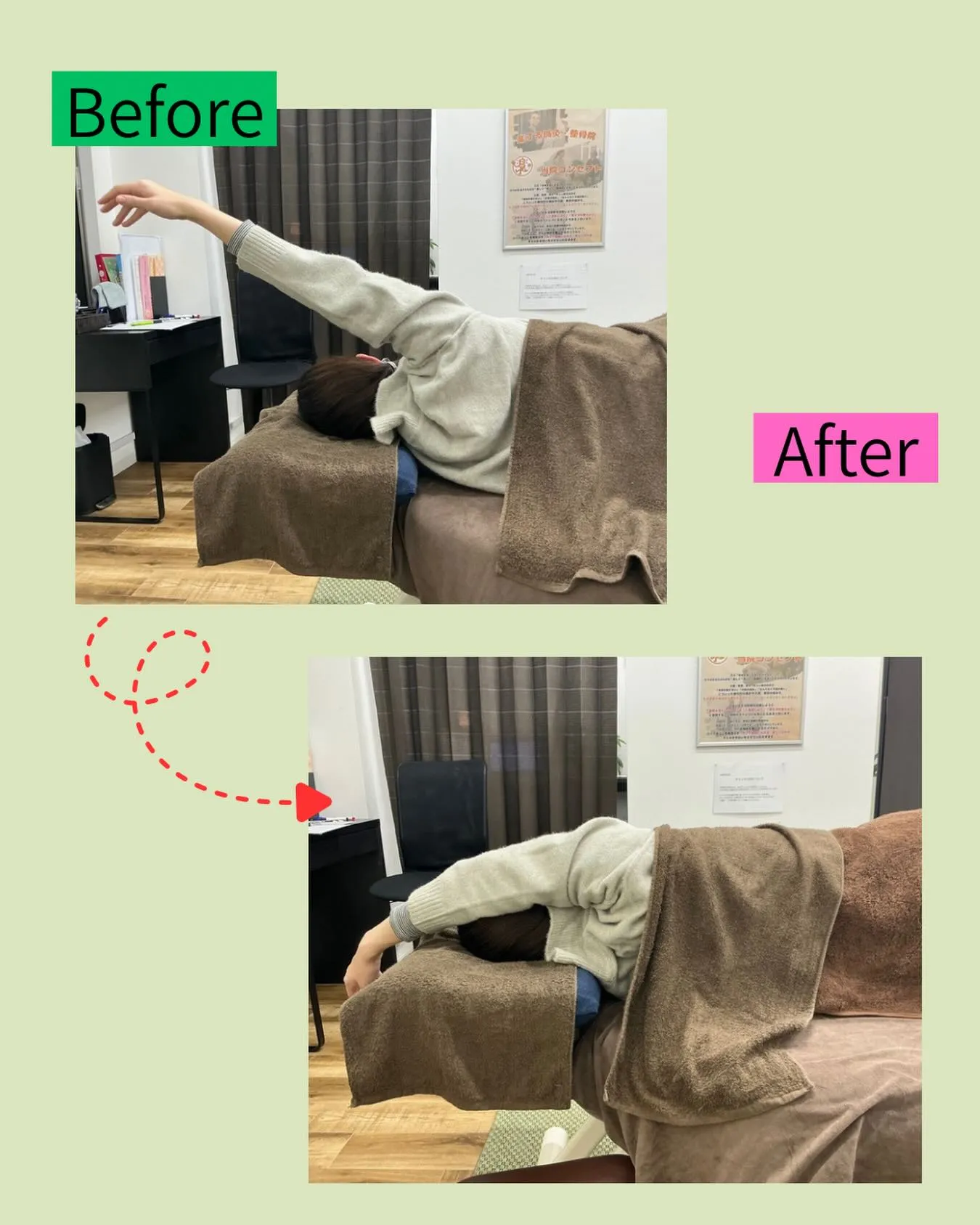 【肩こり・肩甲骨まわりのこりでお悩みの方へ】