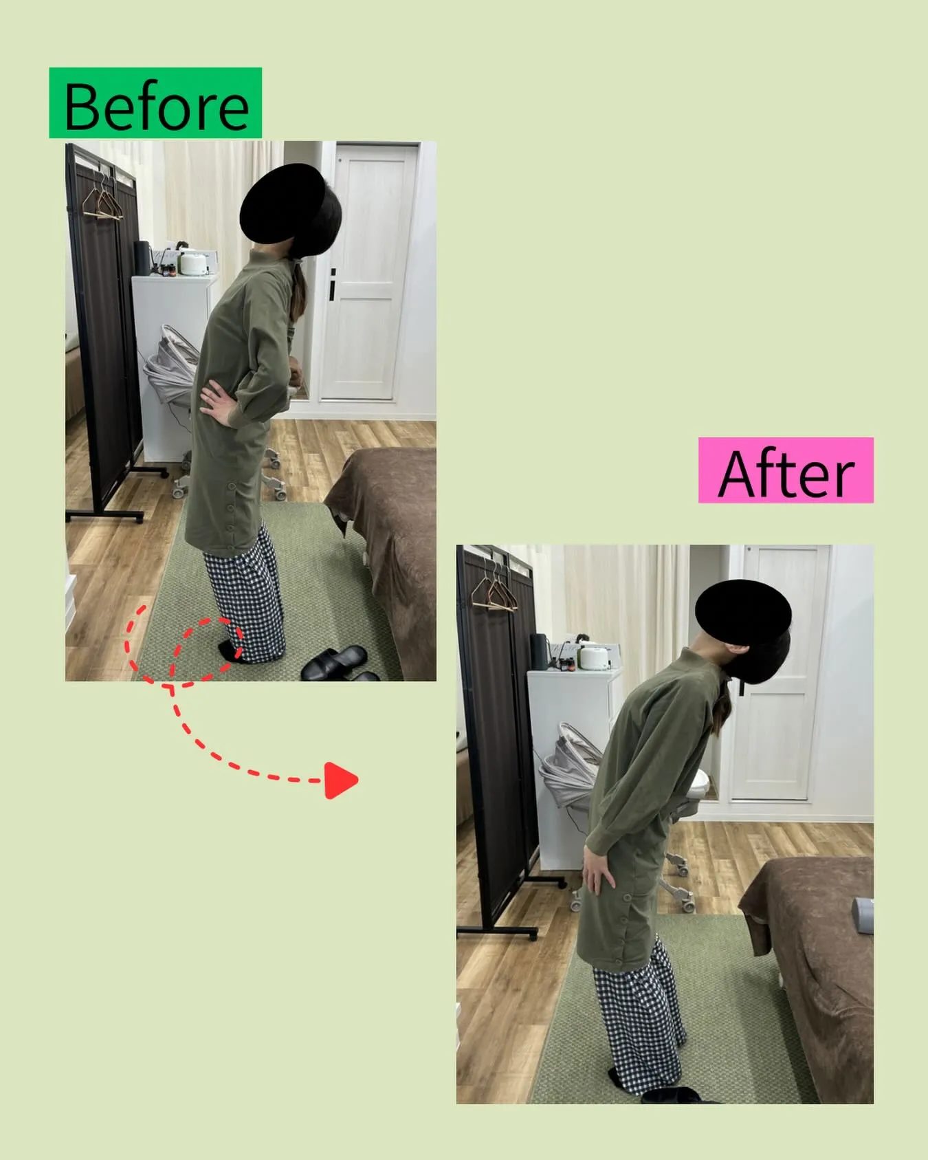 😣🦴【腰痛・反り腰でお悩みの方へ】🦴😣