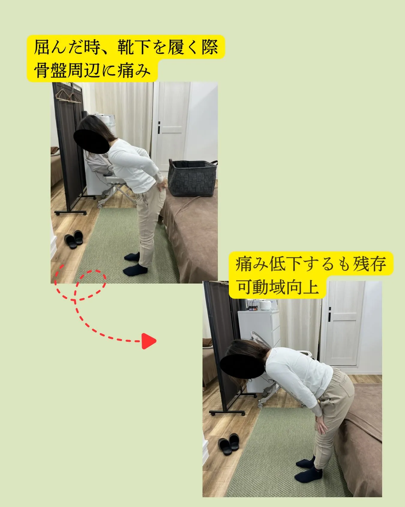 【突然のギックリ腰、放置していませんか？⚠️】