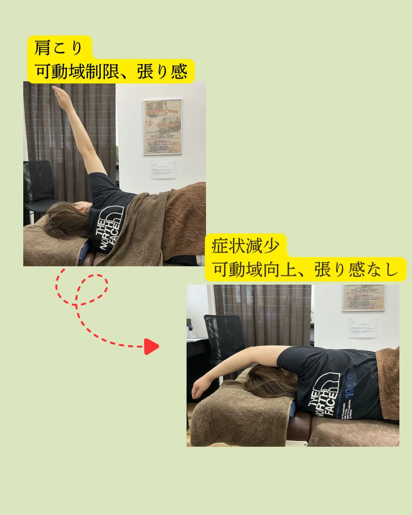【肩甲骨、しっかり動いていますか?⚠️】