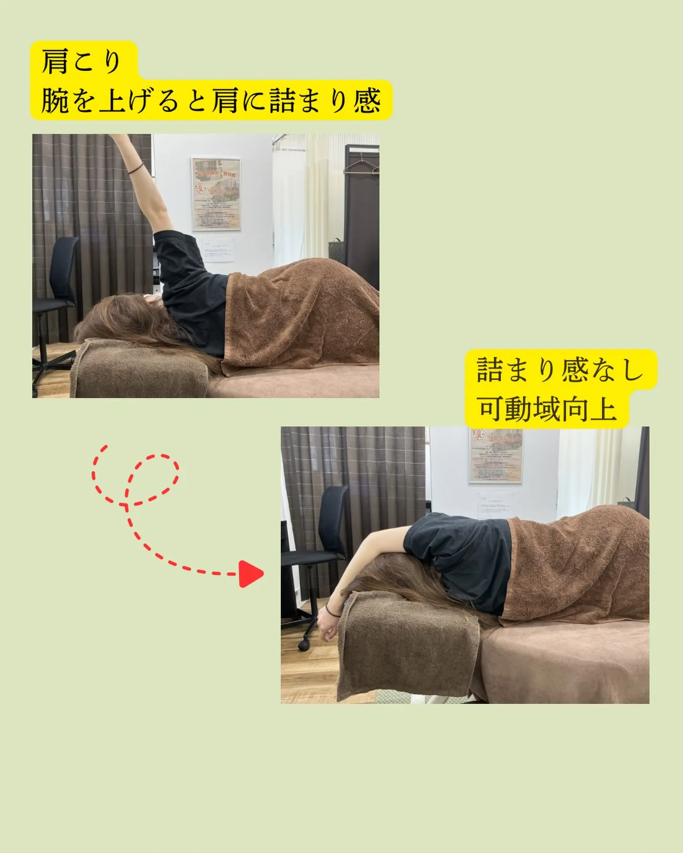 【肩こり・肩甲骨のつらさ…鍼治療と整体でスッキリしませんか?...