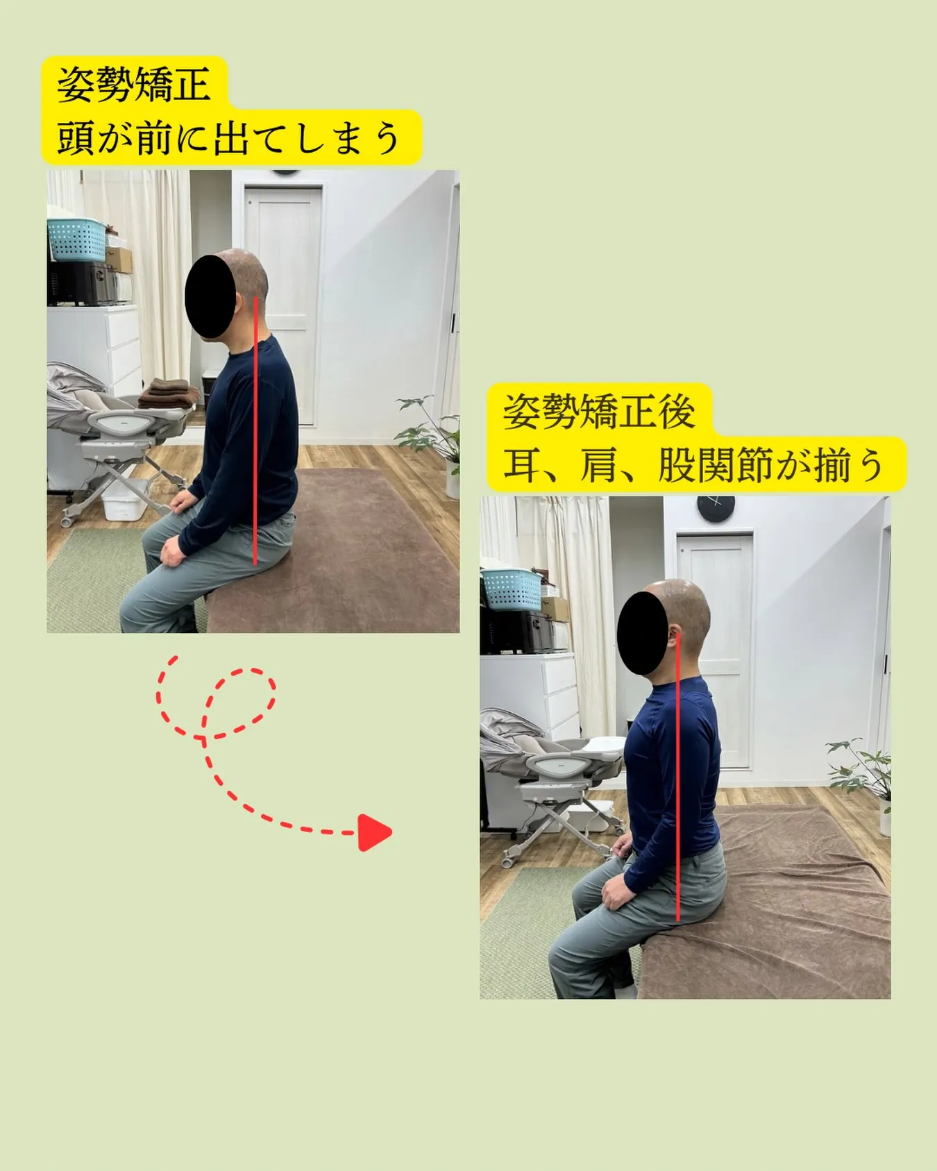【姿勢矯正・猫背・巻き肩でお悩みではありませんか？📱💻】