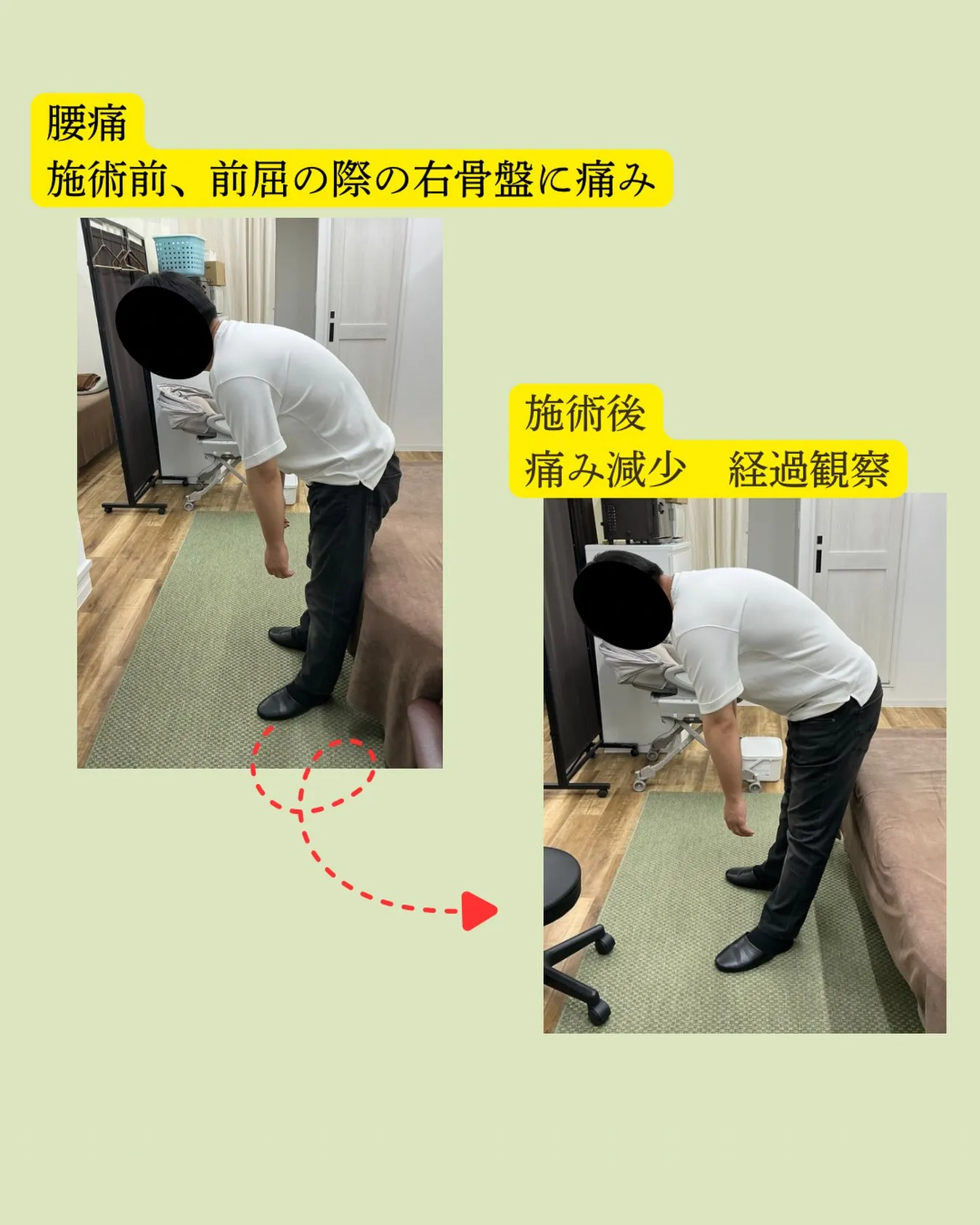 【腰痛・ギックリ腰を繰り返していませんか?😣】