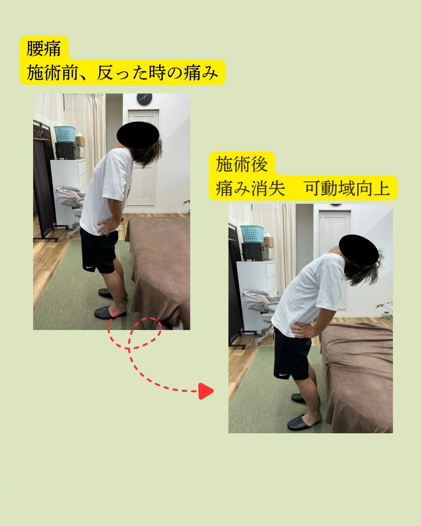 【腰の張り・疲れ・反り腰でお悩みではありませんか？😣】
