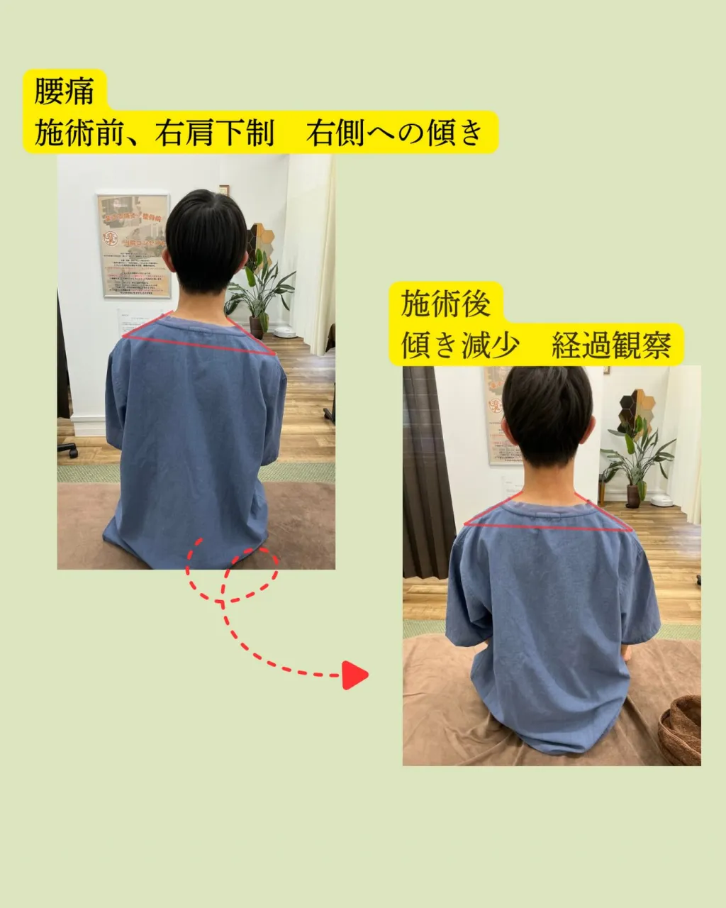 【姿勢矯正・猫背・巻き肩でお悩みではありませんか?😣💦】