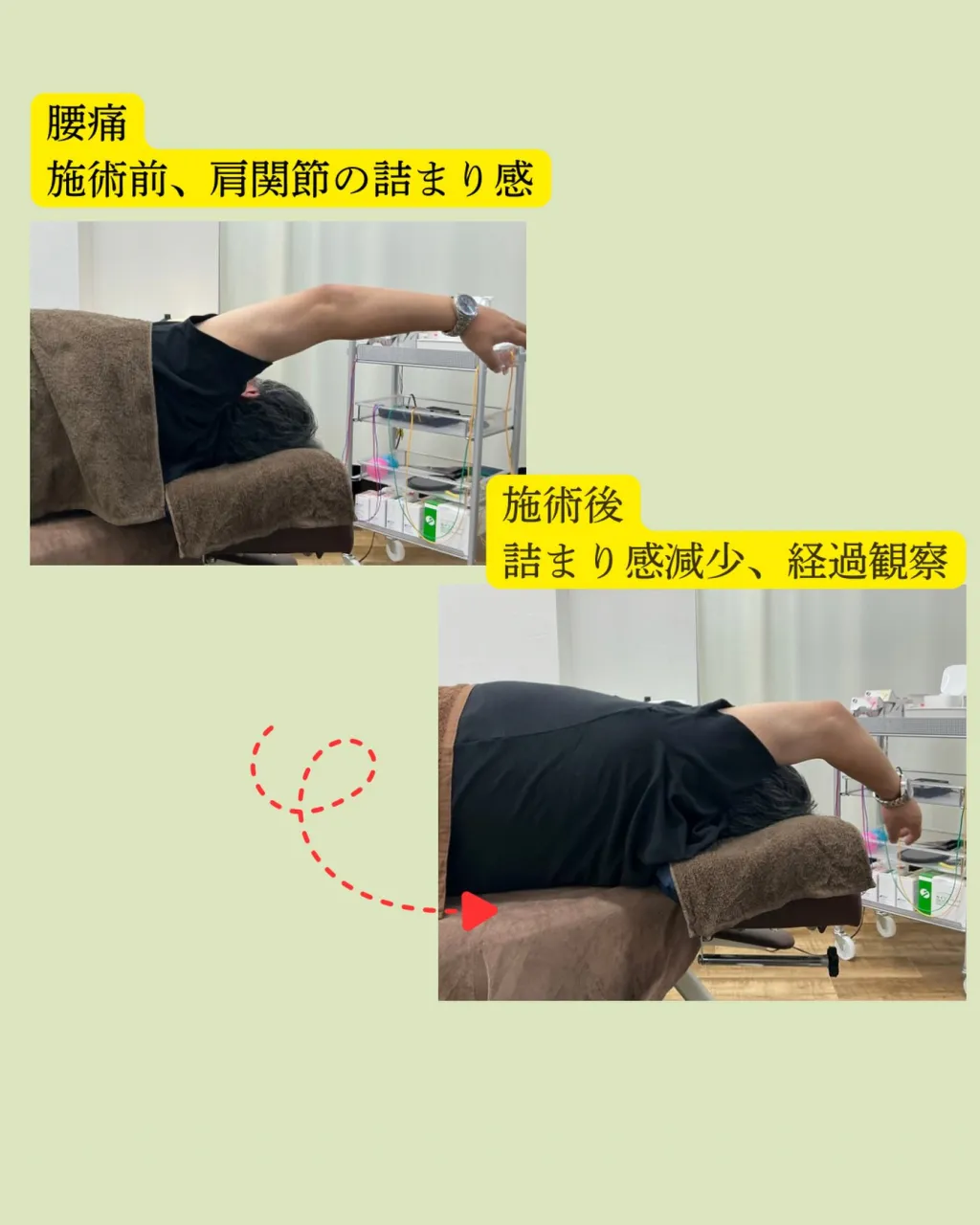 【肩が上がらない…腕を動かすと痛い…】