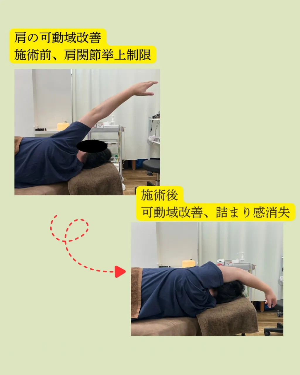 【肩こり・巻き肩・肩甲骨周りの不調でお悩みではありませんか？...