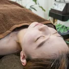 美容鍼
