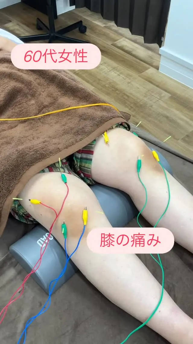 🏃‍♂️膝の痛みでお悩みではありませんか？
